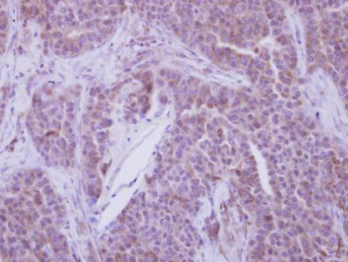 YBX2 Antibody in Immunohistochemistry (Paraffin) (IHC (P))