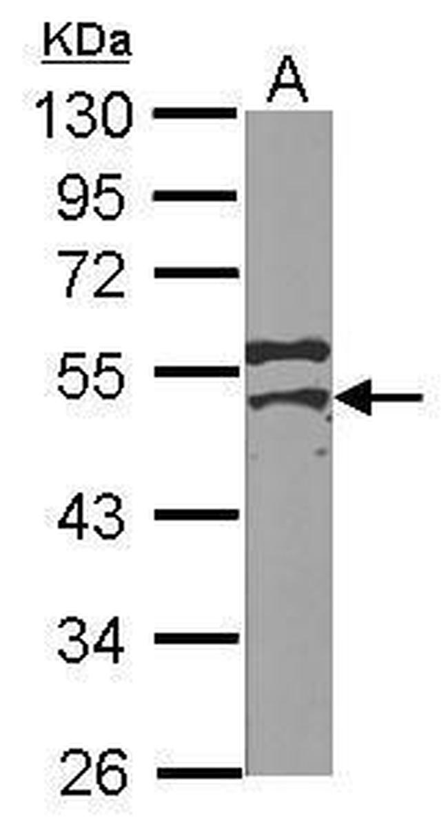 YBX2 Antibody in Western Blot (WB)