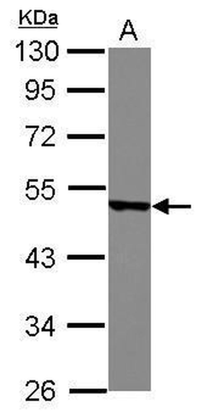 YBX2 Antibody in Western Blot (WB)