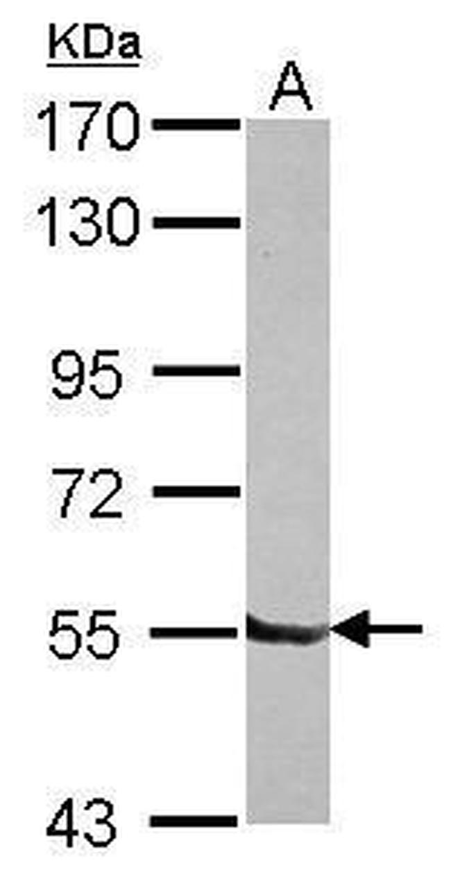 DBR1 Antibody in Western Blot (WB)