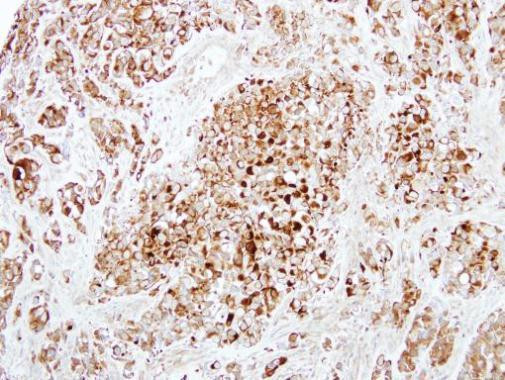 DCXR Antibody in Immunohistochemistry (Paraffin) (IHC (P))