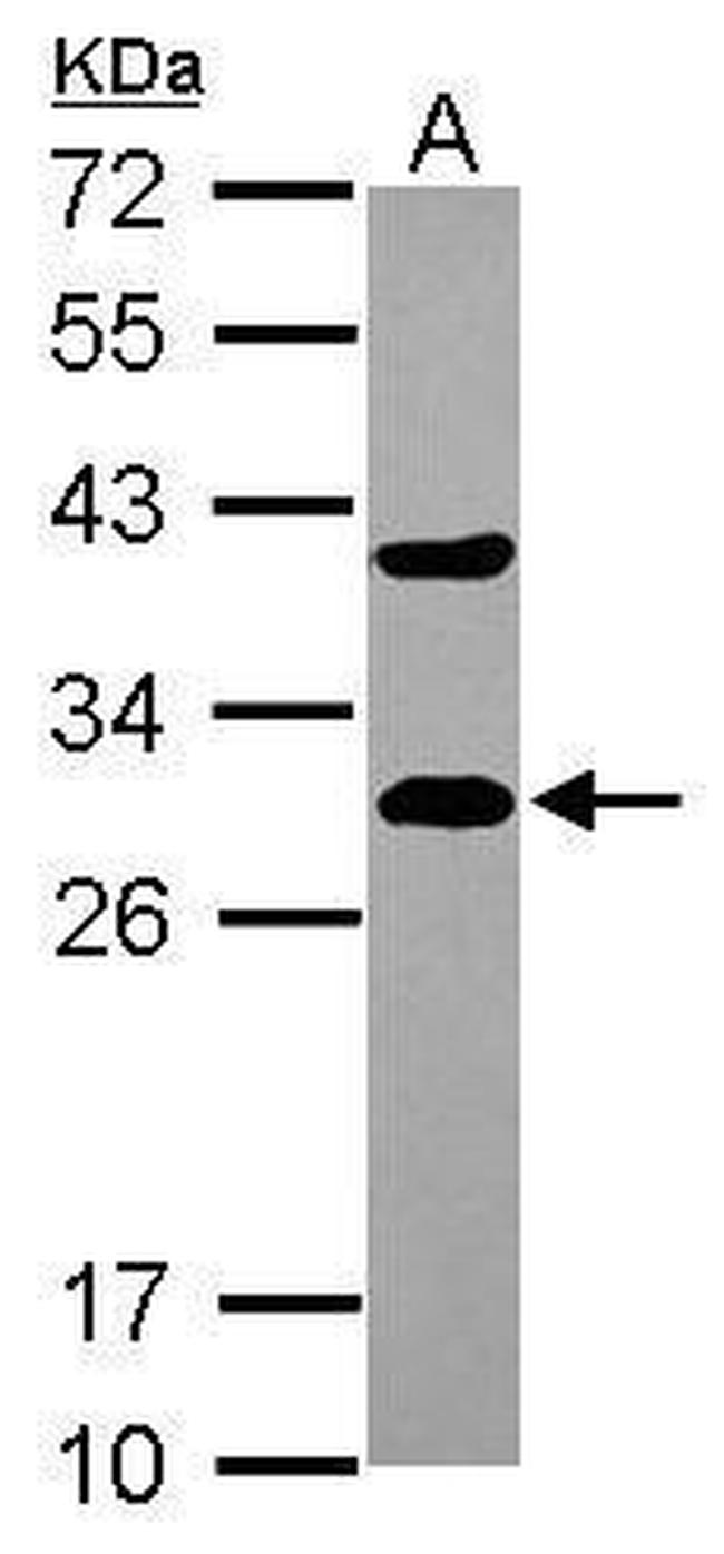 DCXR Antibody in Western Blot (WB)