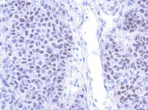 PIASy Antibody in Immunohistochemistry (Paraffin) (IHC (P))