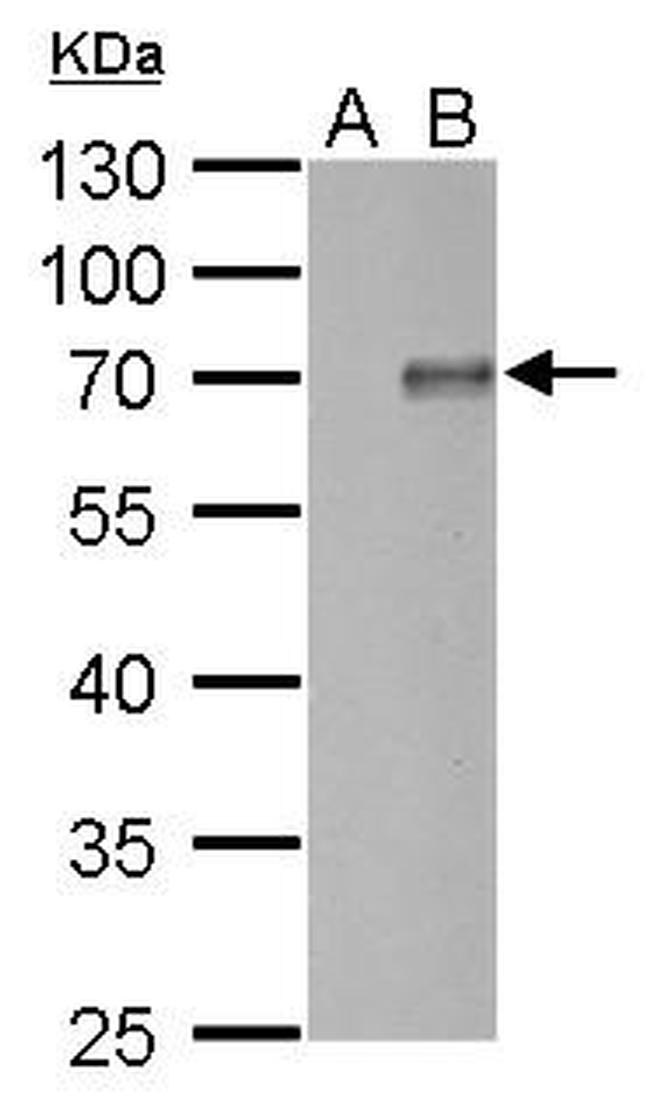 PIASy Antibody in Western Blot (WB)