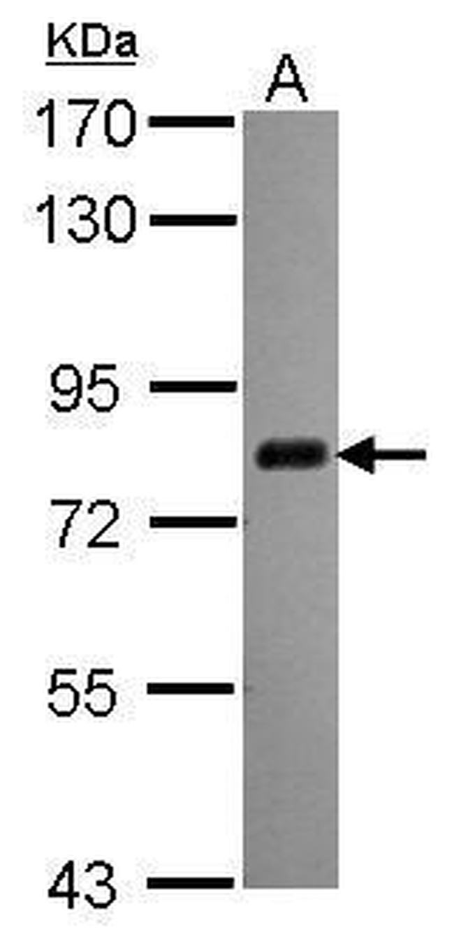 CPSF3 Antibody in Western Blot (WB)