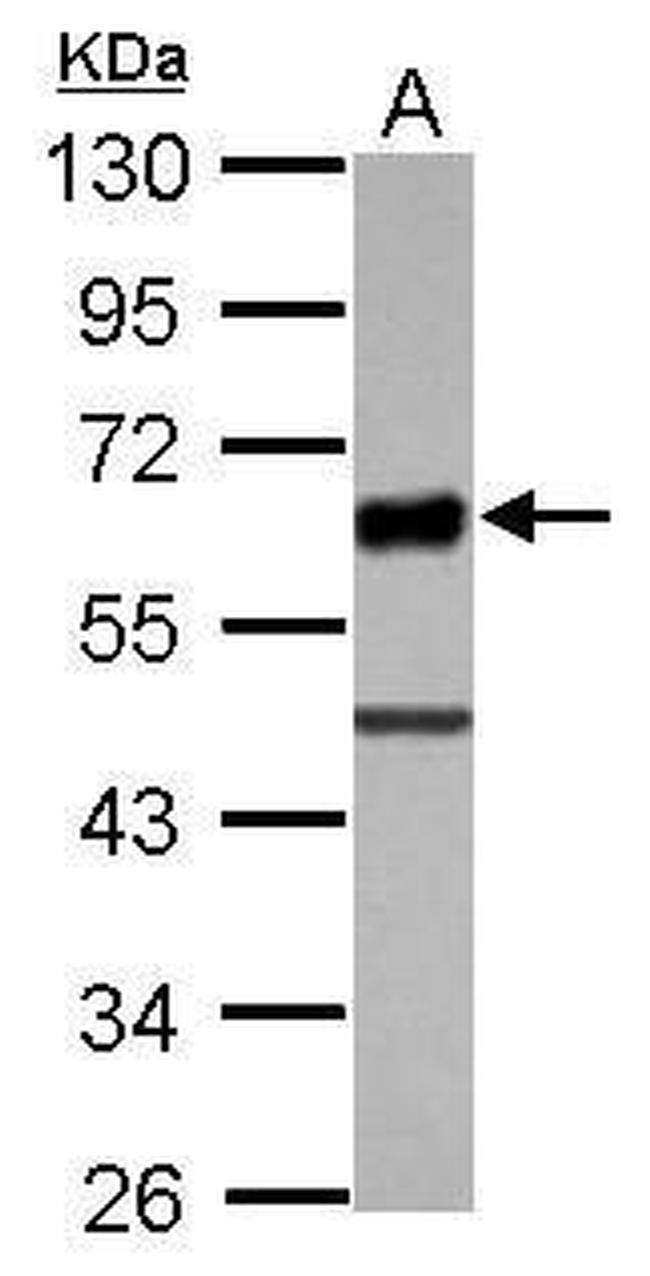 UBASH3A Antibody in Western Blot (WB)