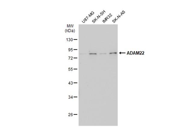 ADAM22 Antibody in Western Blot (WB)