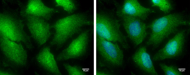 TRIM25 Antibody in Immunocytochemistry (ICC/IF)