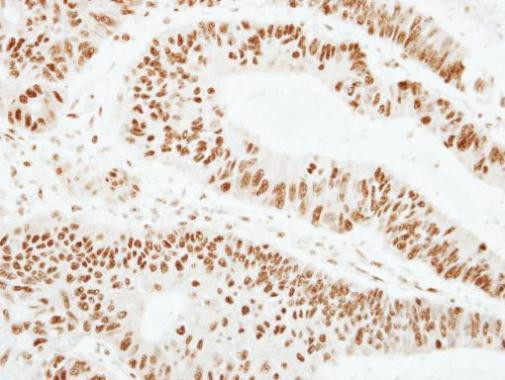 ZNF207 Antibody in Immunohistochemistry (Paraffin) (IHC (P))