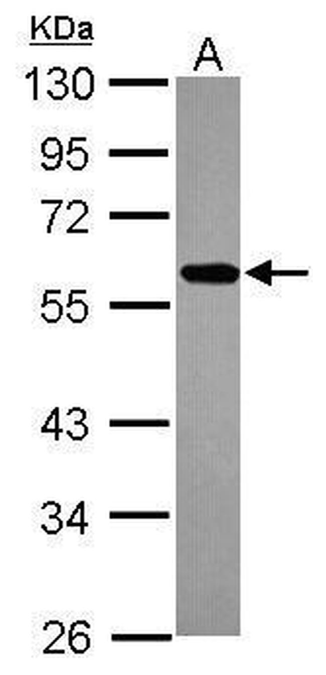 ZNF207 Antibody in Western Blot (WB)