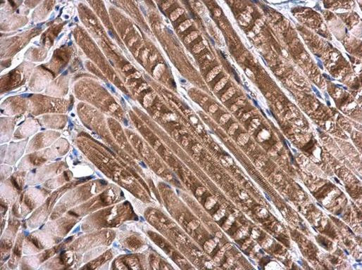 DNALI1 Antibody in Immunohistochemistry (Paraffin) (IHC (P))