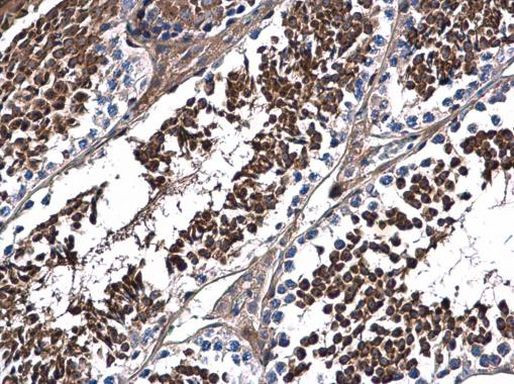 DNALI1 Antibody in Immunohistochemistry (Paraffin) (IHC (P))