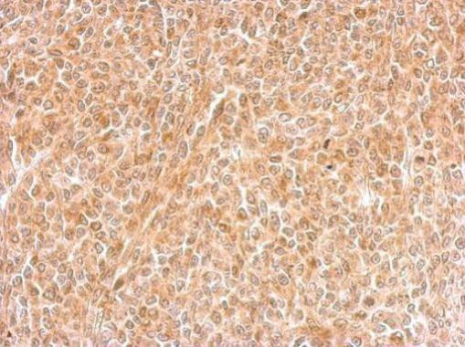 DNALI1 Antibody in Immunohistochemistry (Paraffin) (IHC (P))