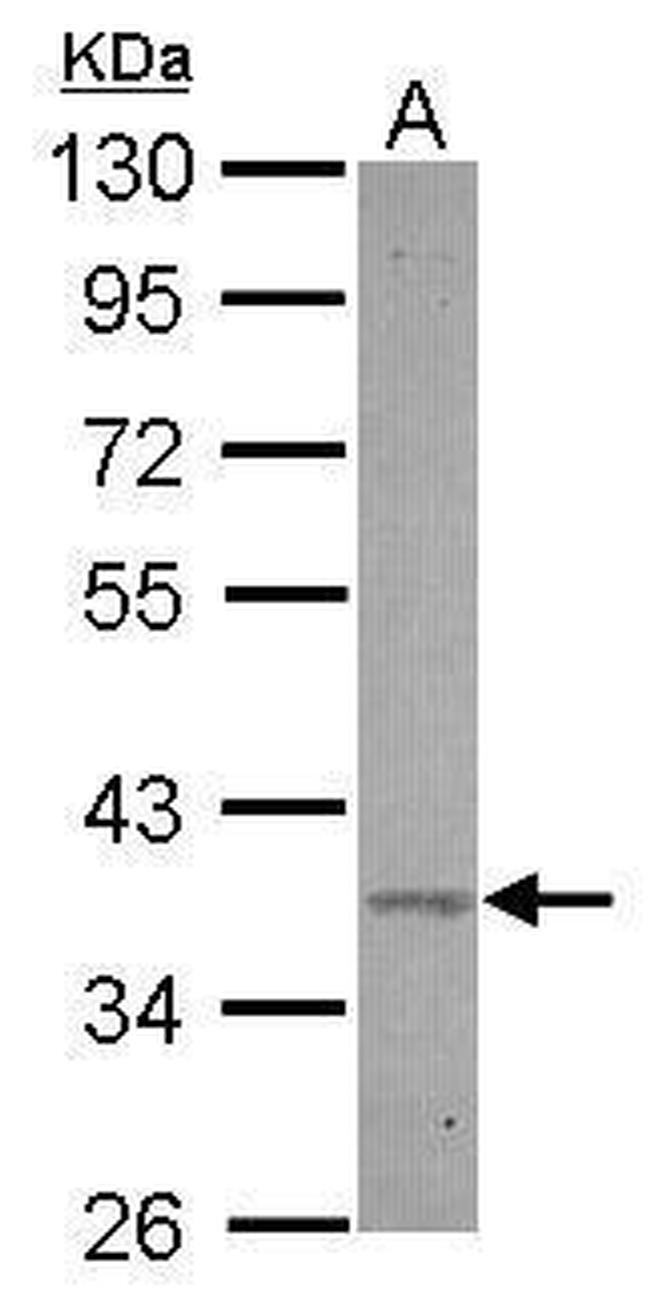 BXDC2 Antibody in Western Blot (WB)