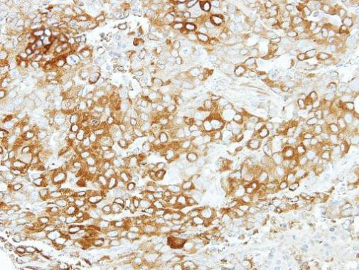 Vezatin Antibody in Immunohistochemistry (Paraffin) (IHC (P))