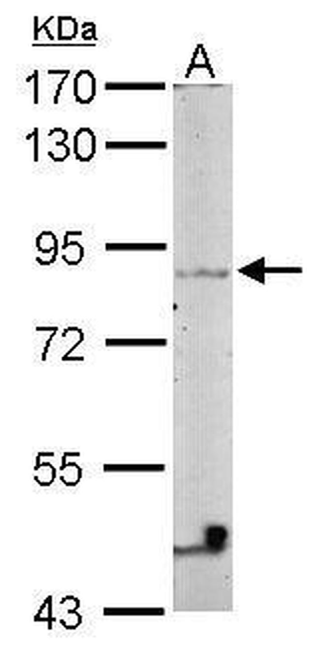 Vezatin Antibody in Western Blot (WB)