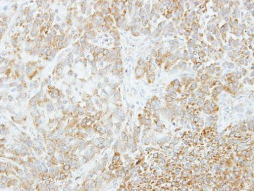 VPS35 Antibody in Immunohistochemistry (Paraffin) (IHC (P))