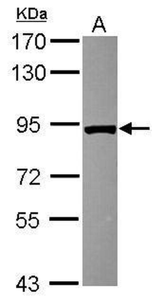 VPS35 Antibody in Western Blot (WB)