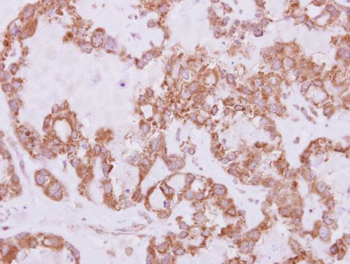 USP47 Antibody in Immunohistochemistry (Paraffin) (IHC (P))