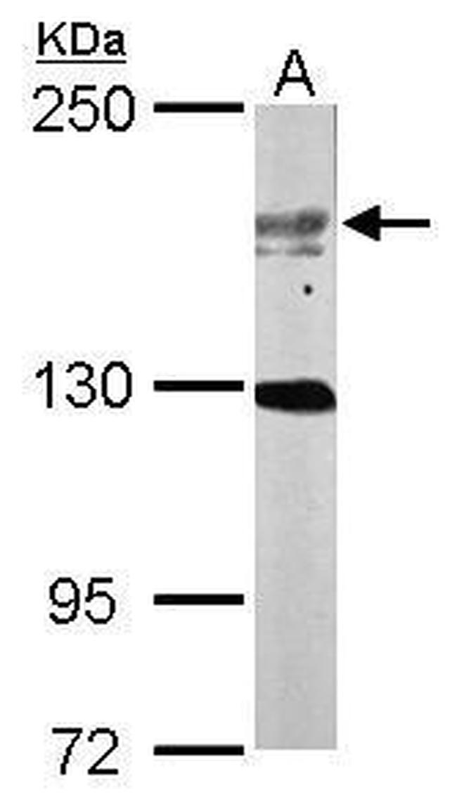 USP47 Antibody in Western Blot (WB)