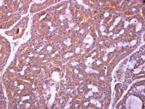 ZWILCH Antibody in Immunohistochemistry (Paraffin) (IHC (P))