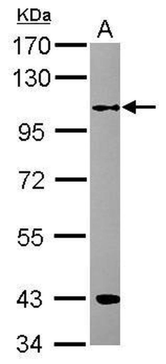 RFWD3 Antibody in Western Blot (WB)