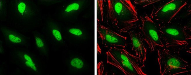 PHF10 Antibody in Immunocytochemistry (ICC/IF)