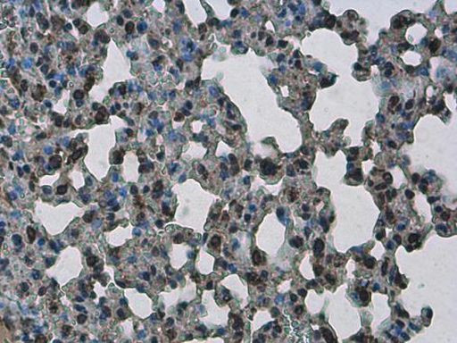 PHF10 Antibody in Immunohistochemistry (Paraffin) (IHC (P))