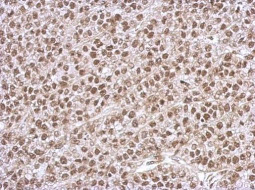 PHF10 Antibody in Immunohistochemistry (Paraffin) (IHC (P))