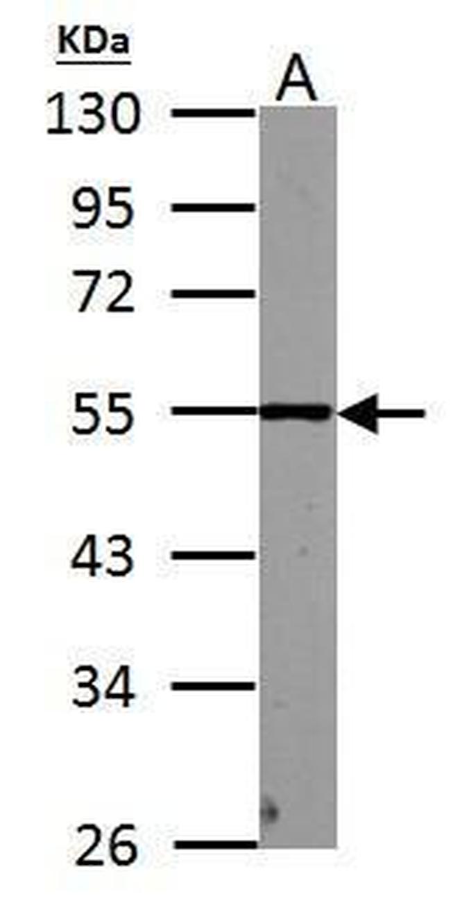PHF10 Antibody in Western Blot (WB)
