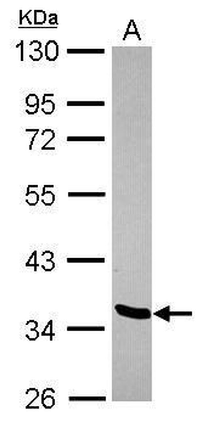 LDB2 Antibody in Western Blot (WB)