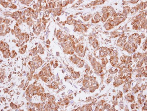 MAGEA4 Antibody in Immunohistochemistry (Paraffin) (IHC (P))