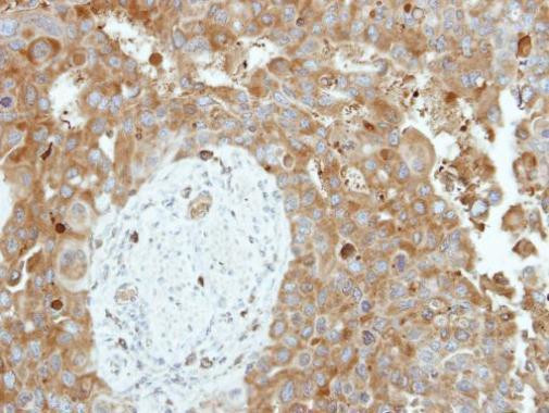 CNDP2 Antibody in Immunohistochemistry (Paraffin) (IHC (P))