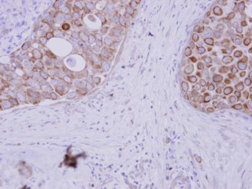 WDSUB1 Antibody in Immunohistochemistry (Paraffin) (IHC (P))