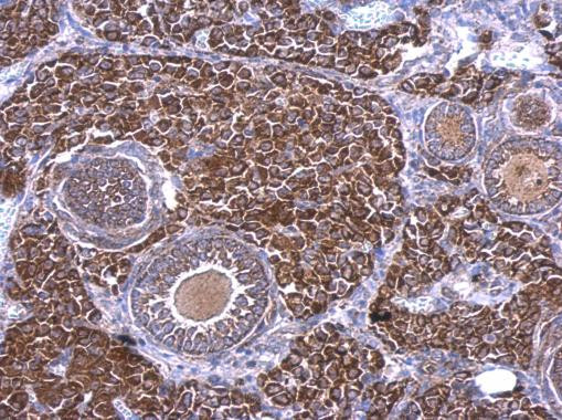 RAB33B Antibody in Immunohistochemistry (Paraffin) (IHC (P))