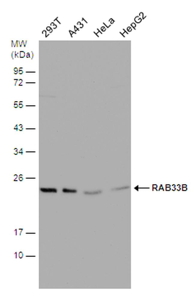 RAB33B Antibody in Western Blot (WB)