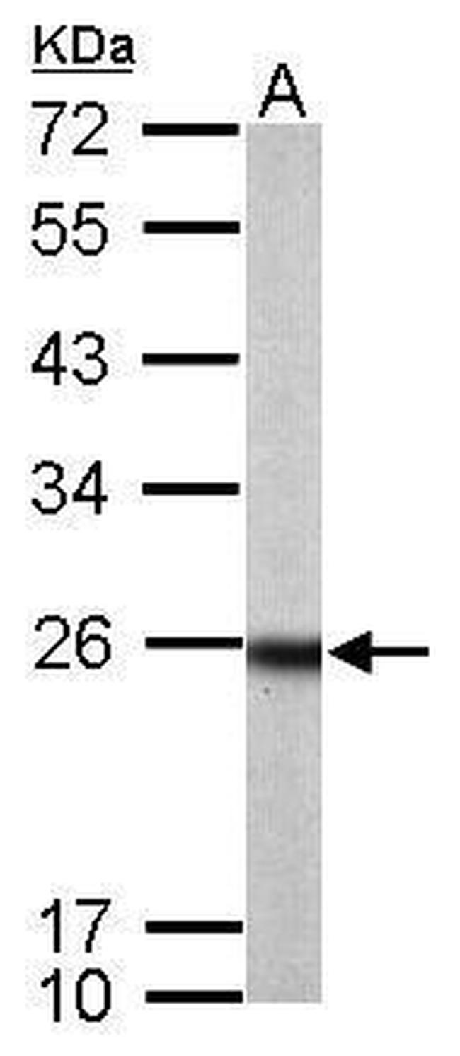 RAB33B Antibody in Western Blot (WB)
