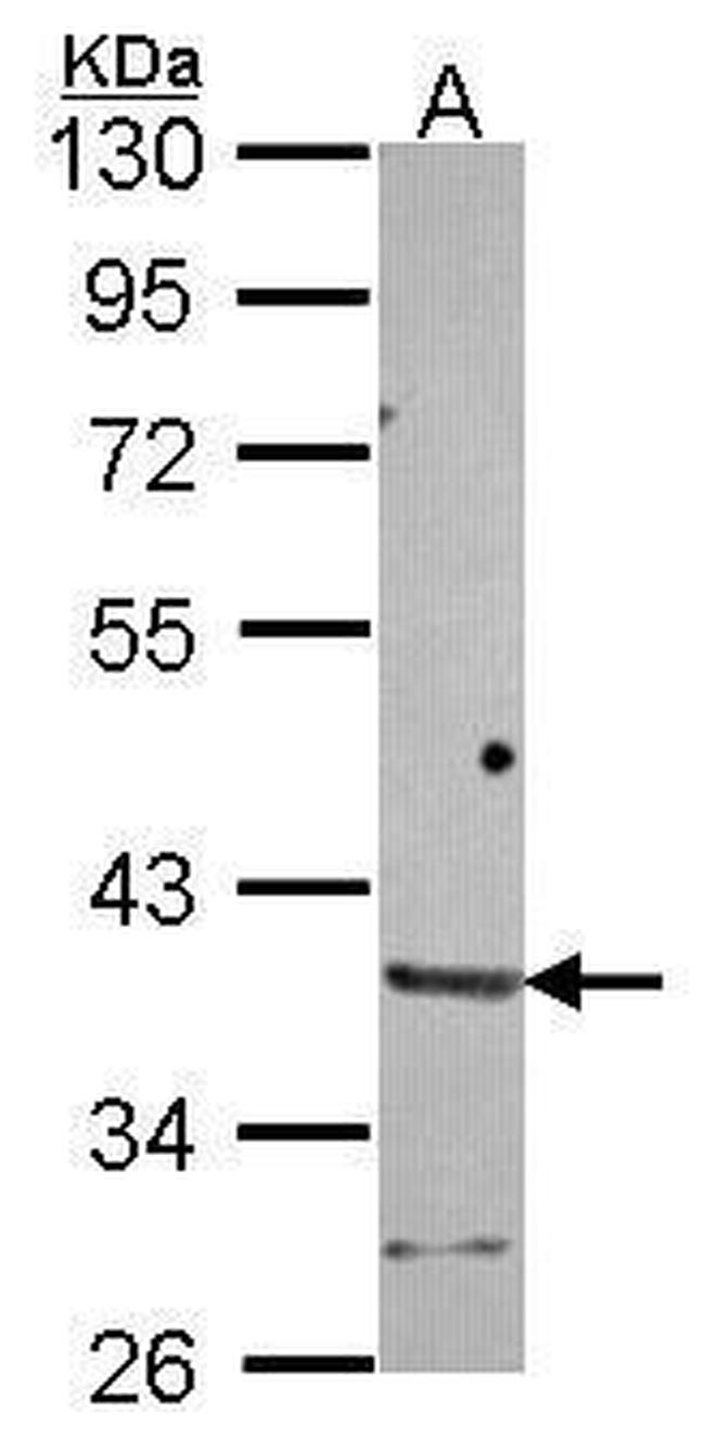 HAPLN2 Antibody in Western Blot (WB)