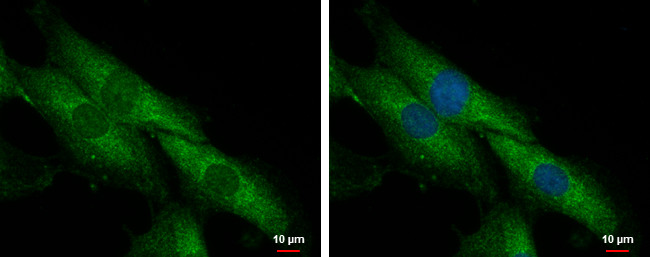 SLC25A23 Antibody in Immunocytochemistry (ICC/IF)