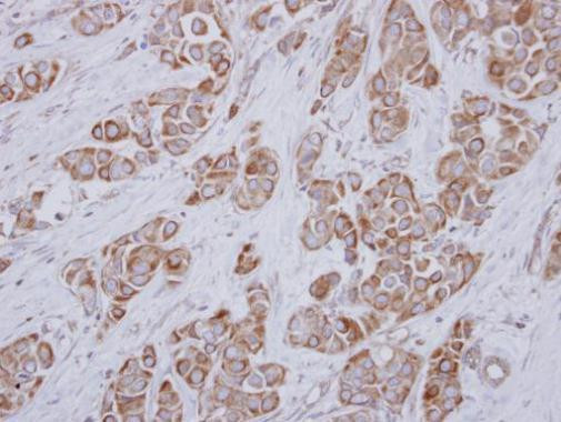 SLC25A23 Antibody in Immunohistochemistry (Paraffin) (IHC (P))