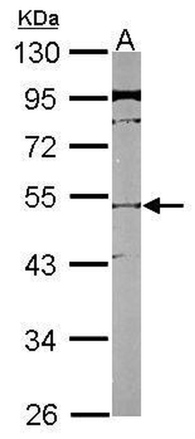 SLC25A23 Antibody in Western Blot (WB)