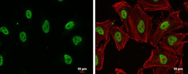 SIN3B Antibody in Immunocytochemistry (ICC/IF)