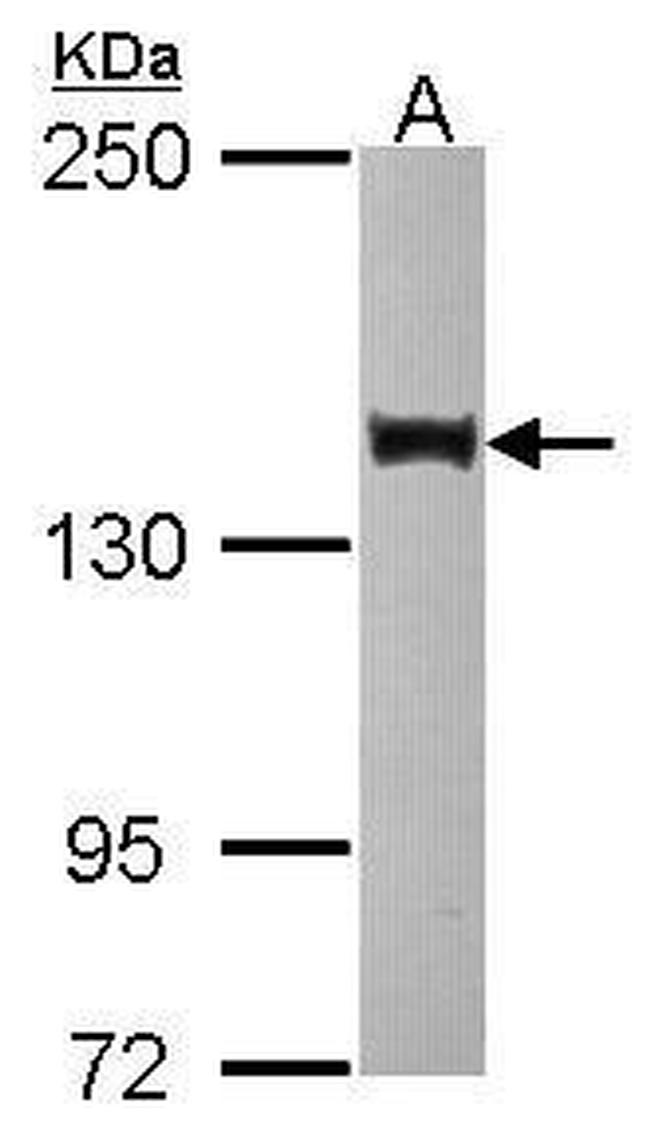 SIN3B Antibody in Western Blot (WB)