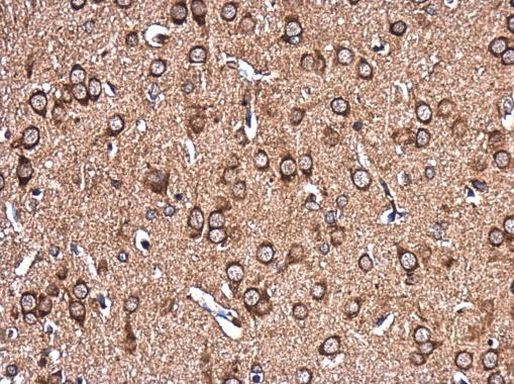 EHD4 Antibody in Immunohistochemistry (Paraffin) (IHC (P))