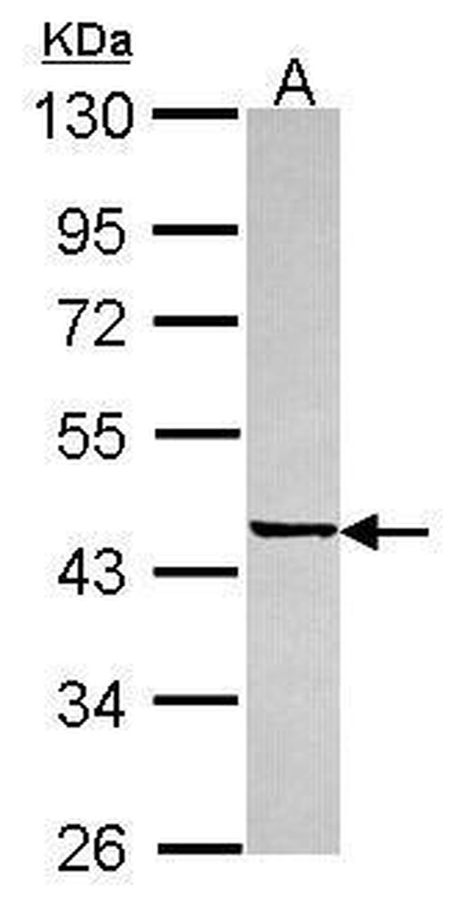 SGCE Antibody in Western Blot (WB)