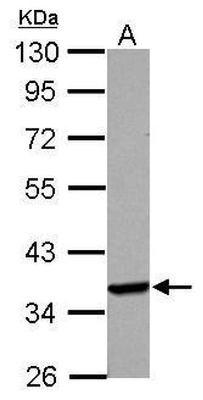 Langerin Antibody in Western Blot (WB)