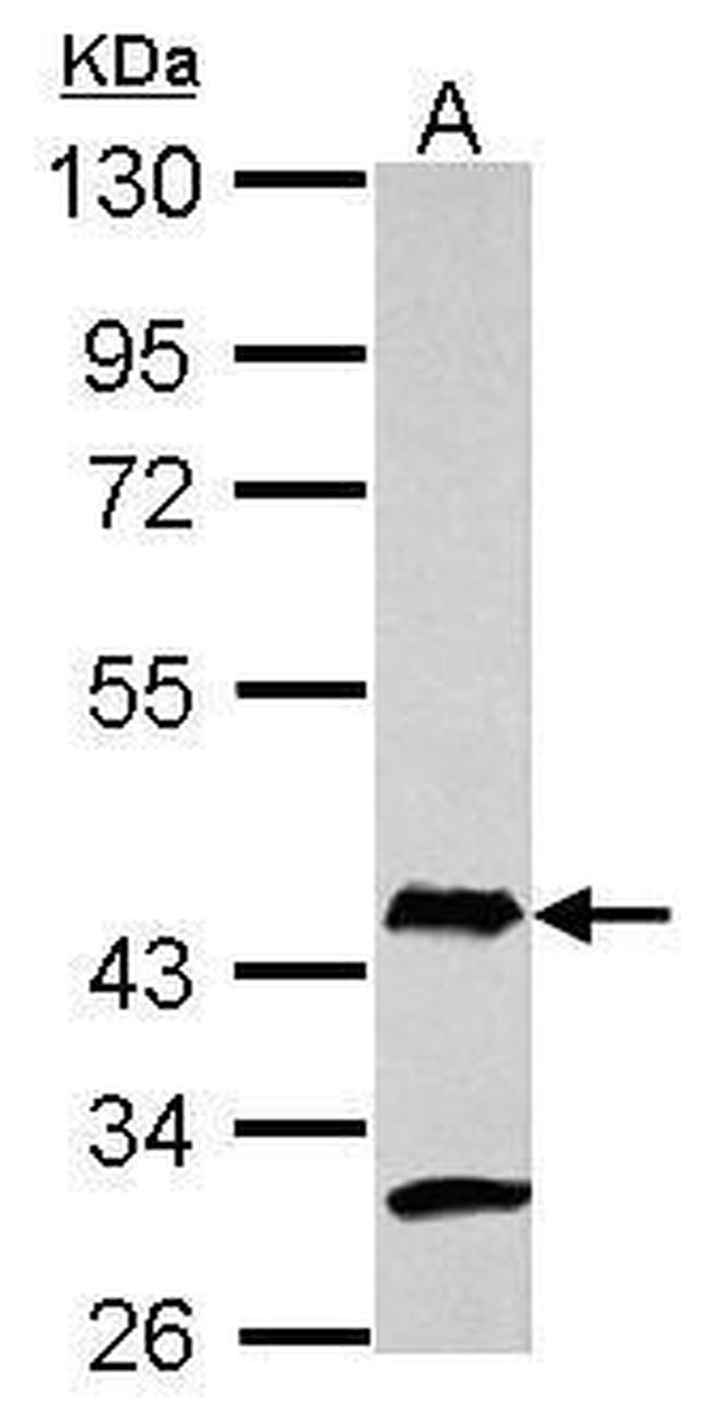 AIM2 Antibody in Western Blot (WB)