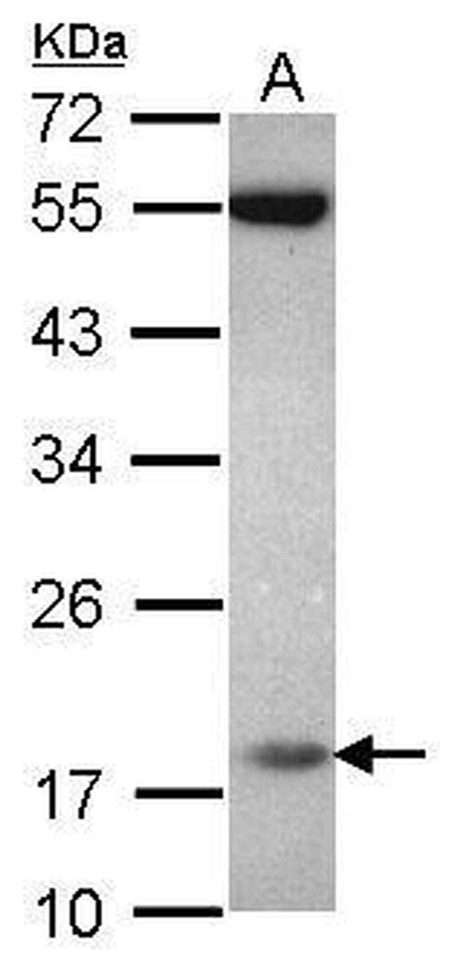 PPIL3 Antibody in Western Blot (WB)