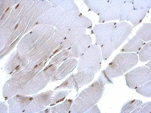 POLE3 Antibody in Immunohistochemistry (Paraffin) (IHC (P))