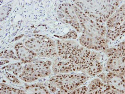 POLE3 Antibody in Immunohistochemistry (Paraffin) (IHC (P))